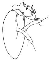 trispinus